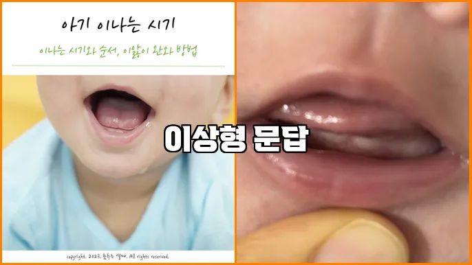이상형 문답